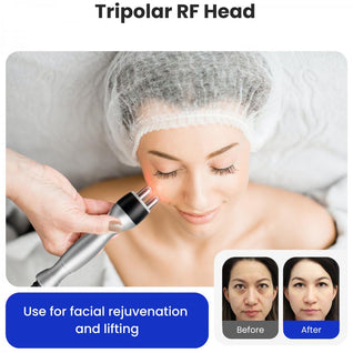 4-in-1 Cavitation Machine + 4 FREE GIFTS