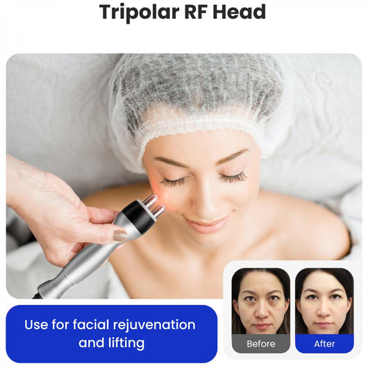 4-in-1 Cavitation Machine + 4 FREE GIFTS
