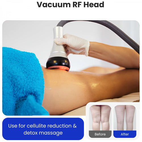 4-in-1 Cavitation Machine + 4 FREE GIFTS