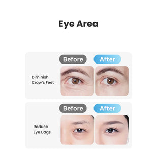 Eye Area