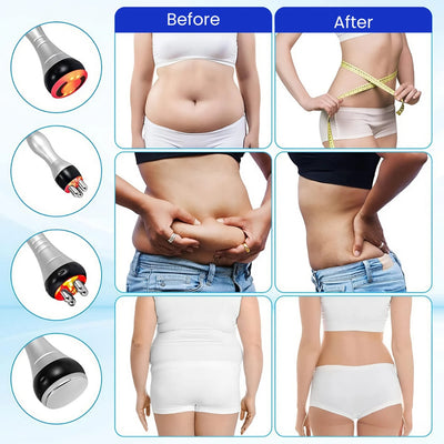 4-in-1 Cavitation Machine + 4 FREE GIFTS