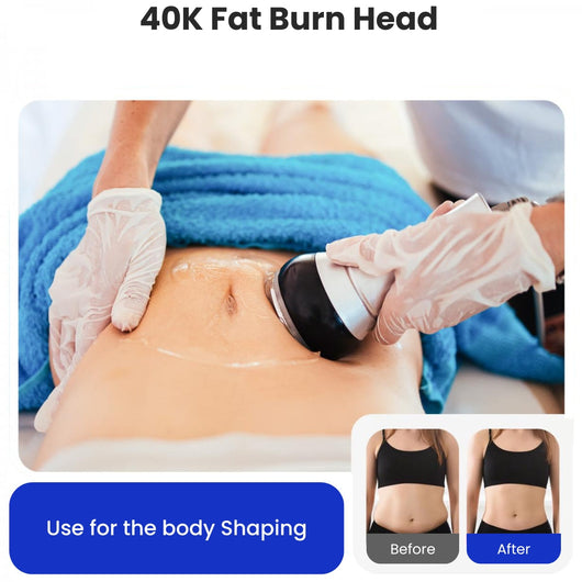 4-in-1 Cavitation Machine + 4 FREE GIFTS