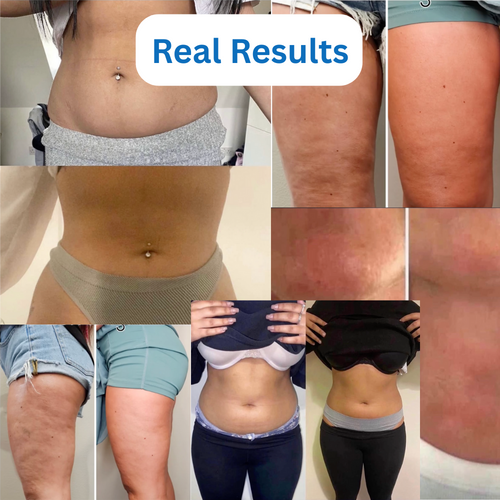 4-in-1 Cavitation Machine + 4 FREE GIFTS