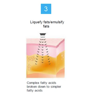 Contours & Firms Your Shape